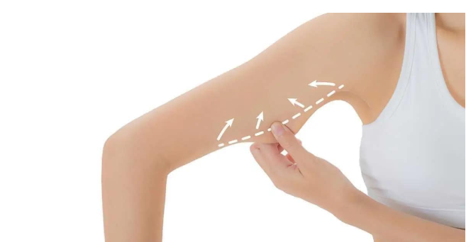 Reductivo de brazo